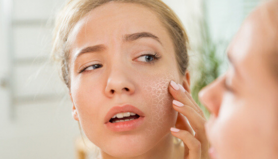 Quel savon solide pour peau sèche ?