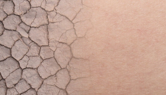 Comment prendre soin d'une peau sèche ?