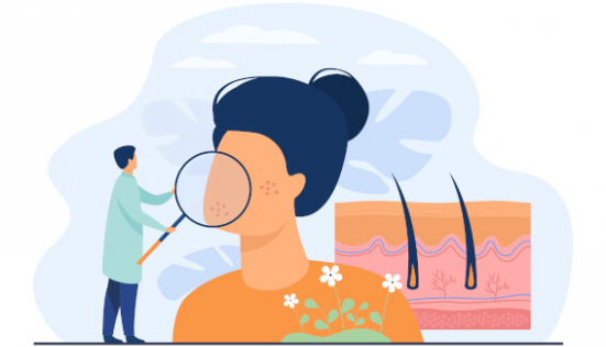 Comment prendre soin d'une peau acnéique ?