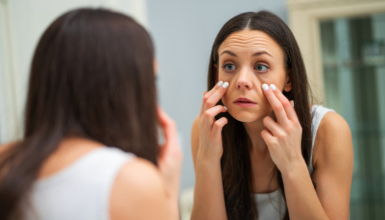 Poche sous les yeux, cernes : comment les atténuer ?
